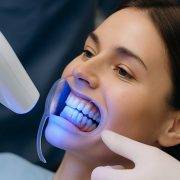 بلیچینگ دندان