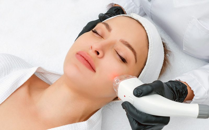 لیزر جای جوش